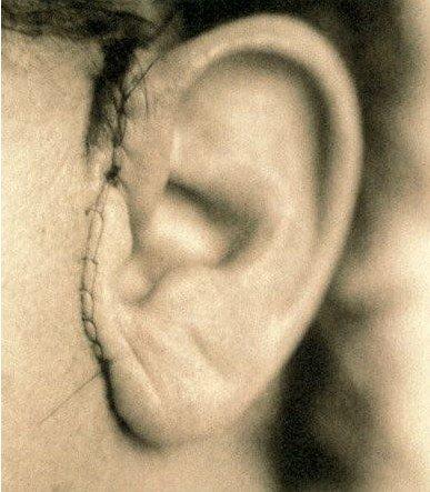 耳畸形的常见7大问题